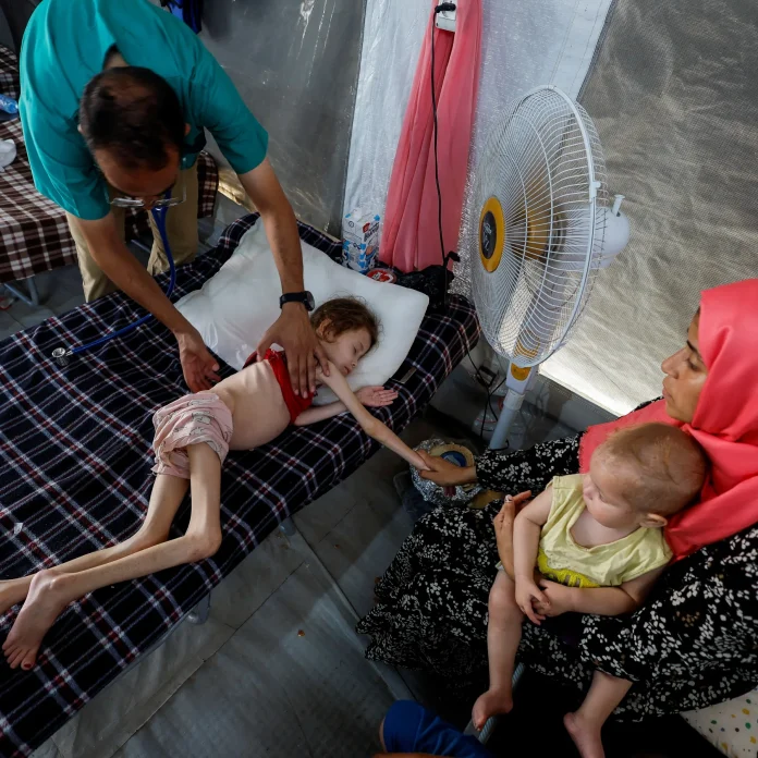 2024-06-22T000000Z_1097383714_RC26G8AIDQHP_RTRMADP_3_ISRAEL-PALESTINIANS-GAZA-MALNUTRITION-1751159238